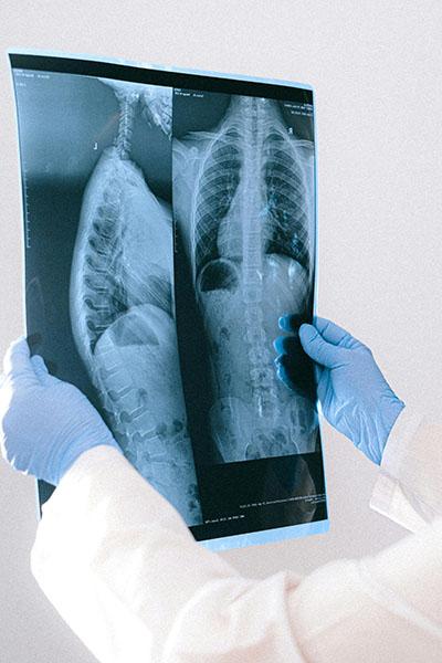 X-ray